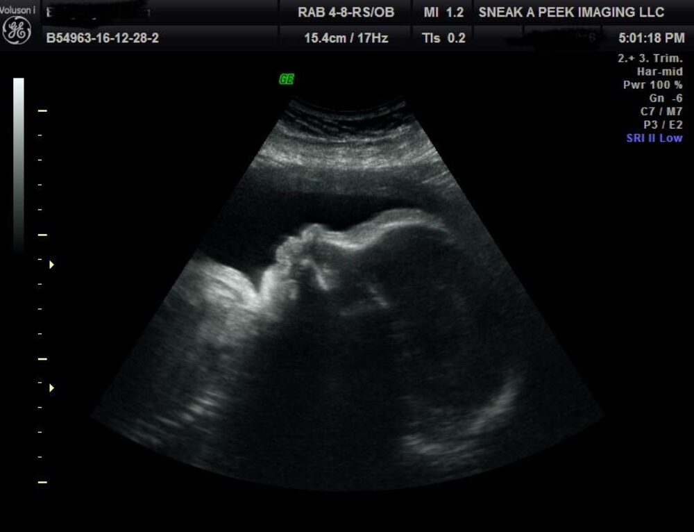 4d ultrasound near me